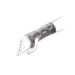 PF Tenortho - Taglia XL (circonferenza polso: 22/24 cm) - Lunghezza 18cm - Lato SX - Destro e Sinistro: Polsiera steccata in tessuto elastico. Tessuto elastico calibrato. Chiusura a velcro. Stecca anatomica in alluminio modellabile.